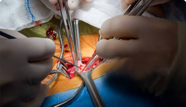Cardiovascula Neurosurgery Instruments